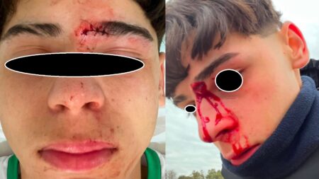 Denuncian que golpearon a jugadores de las menores de Bella Vista en Punta Alta